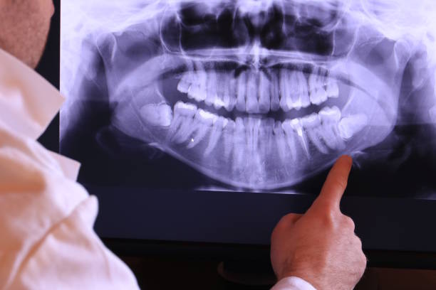 Best Walk-In Emergency Dentist in Proctor, VT