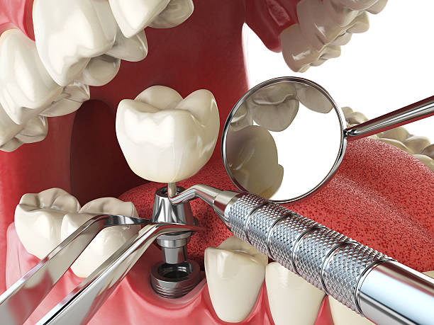 , VT Emergency Dentist Company